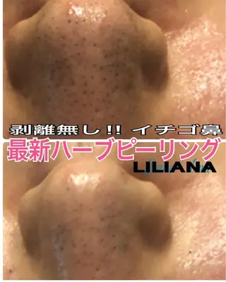 LILIANA ☆YURIのエステ・リラクイメージ
