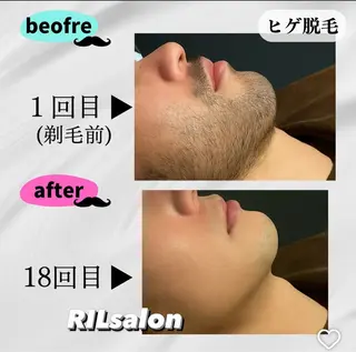 RILsalon 脱毛/フェイシャルのエステ・リラクイメージ