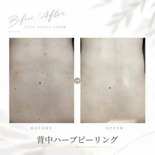 《 肌質×美肌 》 addissimoのエステ・リラクイメージ