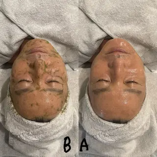 体質改善に特化した パーソナルサロン88のエステ・リラクイメージ