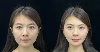 ネイル 愛維美水光専門店 川崎彩鳳のエステ・リラクイメージ