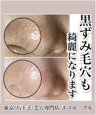 ツヤ肌・美肌サロン (エコル フル)のエステ・リラクイメージ