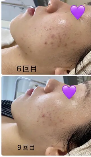 COCO beautyサロンのエステ・リラクイメージ