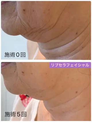 プライベートサロン プリュネルのエステ・リラクイメージ