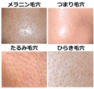 丸の内ヒルズ 今井琴恵のエステ・リラクイメージ