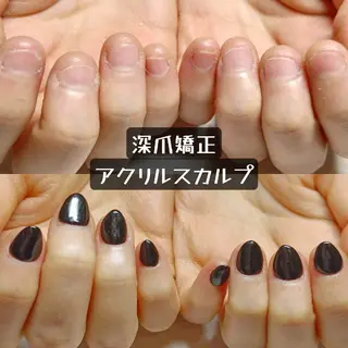 ネイル 深爪矯正/爪育成ケア manie nailのネイルデザイン