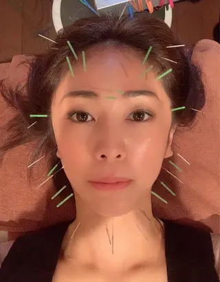 美容鍼灸イロドリ のエステ・リラクイメージ