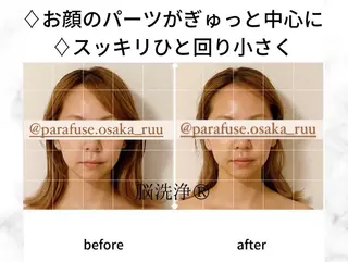 【頭痛、睡眠改善】 salon RUUのエステ・リラクイメージ