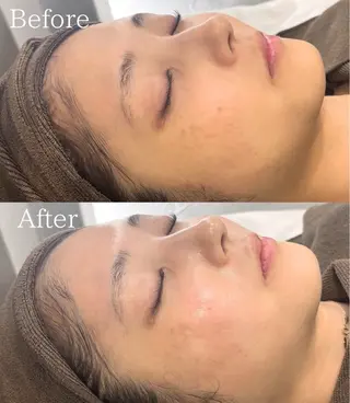 💎Queen Beauty🫧のエステ・リラクイメージ