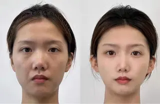 ネイル 愛維美水光専門店 川崎彩鳳のエステ・リラクイメージ