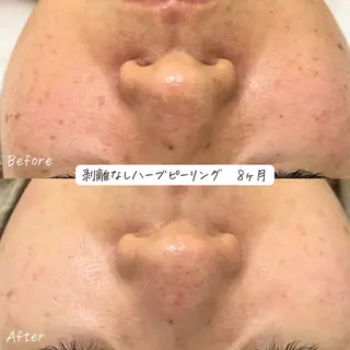 肌質改善サロン renew/ウエキのエステ・リラクイメージ