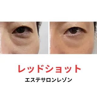 ニキビ・ニキビ跡専門 レゾン京橋店　のエステ・リラクイメージ