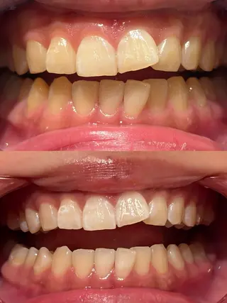 écrusmile ホワイトニングサロンのその他イメージ