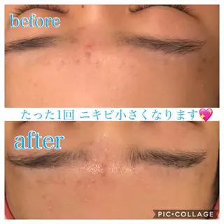 ロング カラー パーマ ヘアアレンジ キッズ ネイル マツエク・マツパ EnsorClair 代表 野口真央のエステ・リラクイメージ