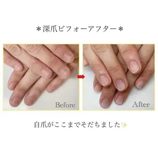 ネイル ネイルサロン アリュームのネイルデザイン
