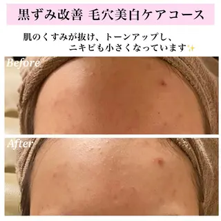 Bellesthe (ベルエステ)のエステ・リラクイメージ