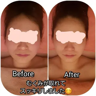 たるみ・ くすみ シミ・ニキビ肌改善のエステ・リラクイメージ