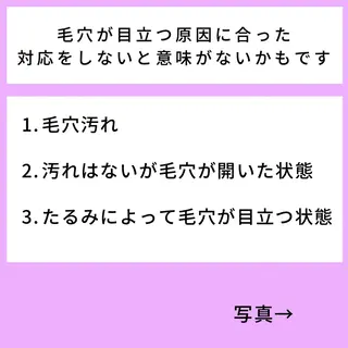 美容鍼と美肌専門 ハリステリアのエステ・リラクイメージ