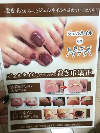 ネイル ♢ME2ROOM♢ #巻き爪#リラクのネイルデザイン