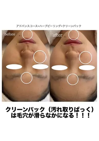 メナード MIYUのその他イメージ