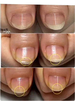 ネイル 自爪育成/深爪矯正 salon fam_のネイルデザイン