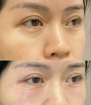 愛維美水光美肌専門店 メンズレディースokのエステ・リラクイメージ