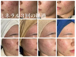 毛穴・肌質改善サロン ✨Tomaのエステ・リラクイメージ