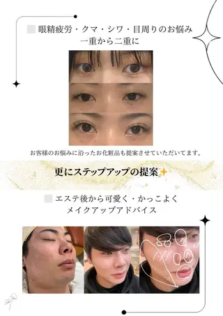 メンズ 肌質改善🫧 みゆのエステ・リラクイメージ