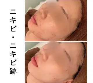 ハーブピーリング専門 BIOPLUS+川崎のエステ・リラクイメージ