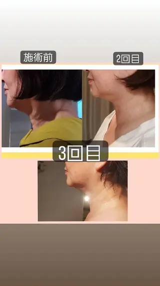 face&body mori'sroomのエステ・リラクイメージ