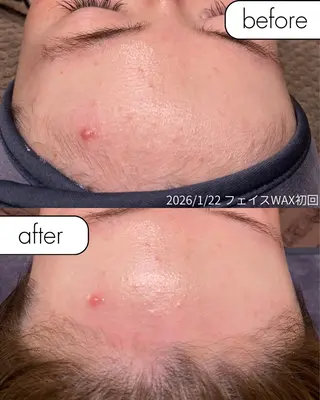 肌質改善サロン with Uのエステ・リラクイメージ