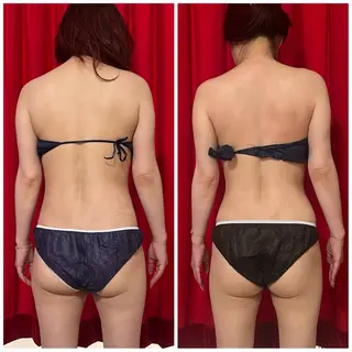 オンダリフト・美肌 Red しずるのエステ・リラクイメージ