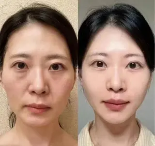 ネイル 愛維美水光専門店 川崎彩鳳のエステ・リラクイメージ