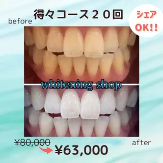 メンズ ホワイトニング ショップ高田馬場店のその他イメージ