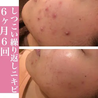 ミディアム カラー パーマ ヘアアレンジ メンズ キッズ ネイル マツエク・マツパ ニキビ・肌質改善専門 ♡人生が変わるサロンのエステ・リラクイメージ