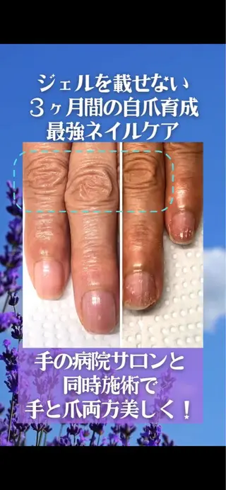 ネイル 自爪育成ネイルサロン Pause(ポーズ)のネイルデザイン