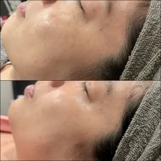 LiZA エステティックサロンのエステ・リラクイメージ