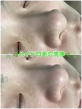 脱毛&美容サロン Dr.Epiのエステ・リラクイメージ