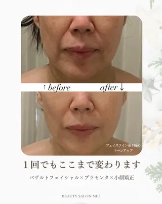 35歳からの エイジングケアサロンのエステ・リラクイメージ
