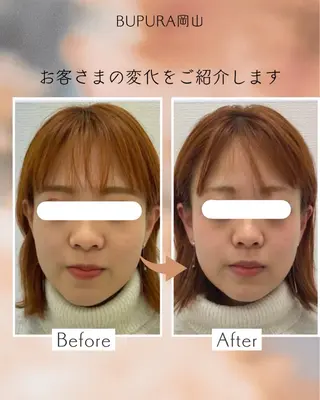 小顔矯正＆肌質改善 BUPURA岡山のエステ・リラクイメージ