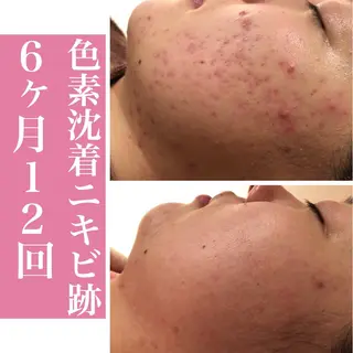 ミディアム カラー パーマ ヘアアレンジ メンズ キッズ ネイル マツエク・マツパ アイブロウ ニキビ・肌質改善専門 ♡人生が変わるサロンのエステ・リラクイメージ