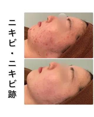 ハーブピーリング専門 BIOPLUS+川崎のエステ・リラクイメージ