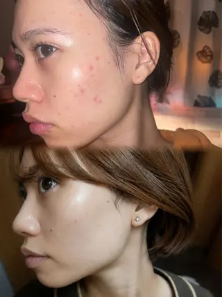 艶肌デトックス🫧 Samiraのエステ・リラクイメージ