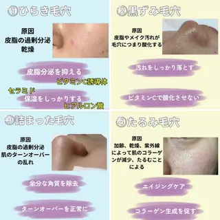 愛維美水光美肌専門店 メンズレディースokのエステ・リラクイメージ