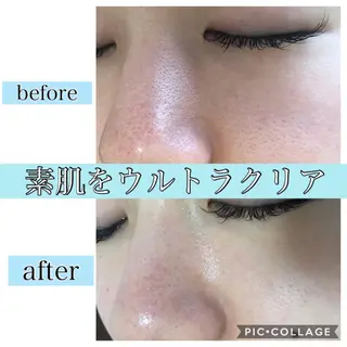 セミロング カラー パーマ ヘアアレンジ キッズ ネイル マツエク・マツパ EnsorClair 代表 野口真央のエステ・リラクイメージ