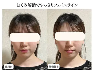 小顔矯正×毛穴サロン DRRAMSPA町田のエステ・リラクイメージ