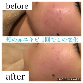 ロング カラー パーマ ヘアアレンジ キッズ ネイル マツエク・マツパ EnsorClair 代表 野口真央のエステ・リラクイメージ