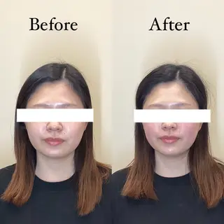 HariLounge 梅田のエステ・リラクイメージ