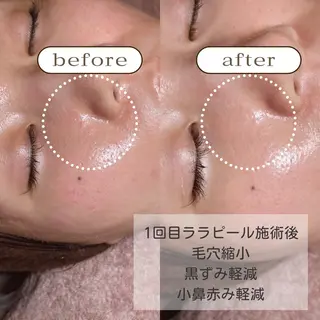 美肌・痩身・脱毛当日 予約◎ZENITHのエステ・リラクイメージ
