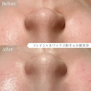 ルコル池袋【毛穴洗浄 /wax顔脱毛】えみのエステ・リラクイメージ